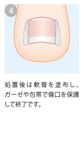 傷口を保護